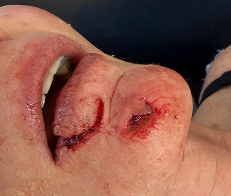 Bonito bite
