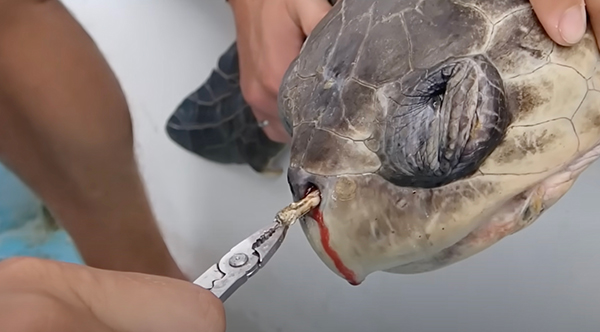 a plastic straw in the nose of an olive ridley turtle